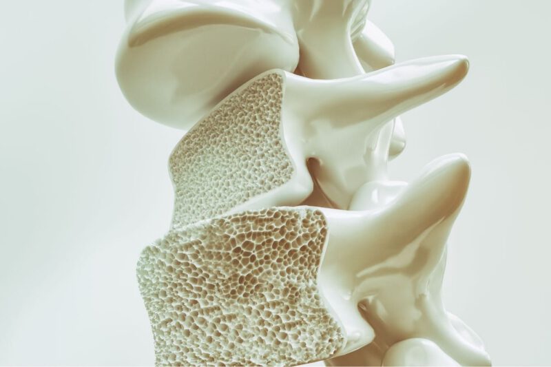 Fakty i mity o osteoporozie