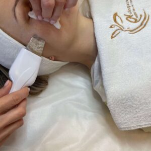 Peeling kawitacyjny